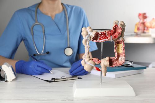 5 Wege, die Darmgesundheit zu verbessern
