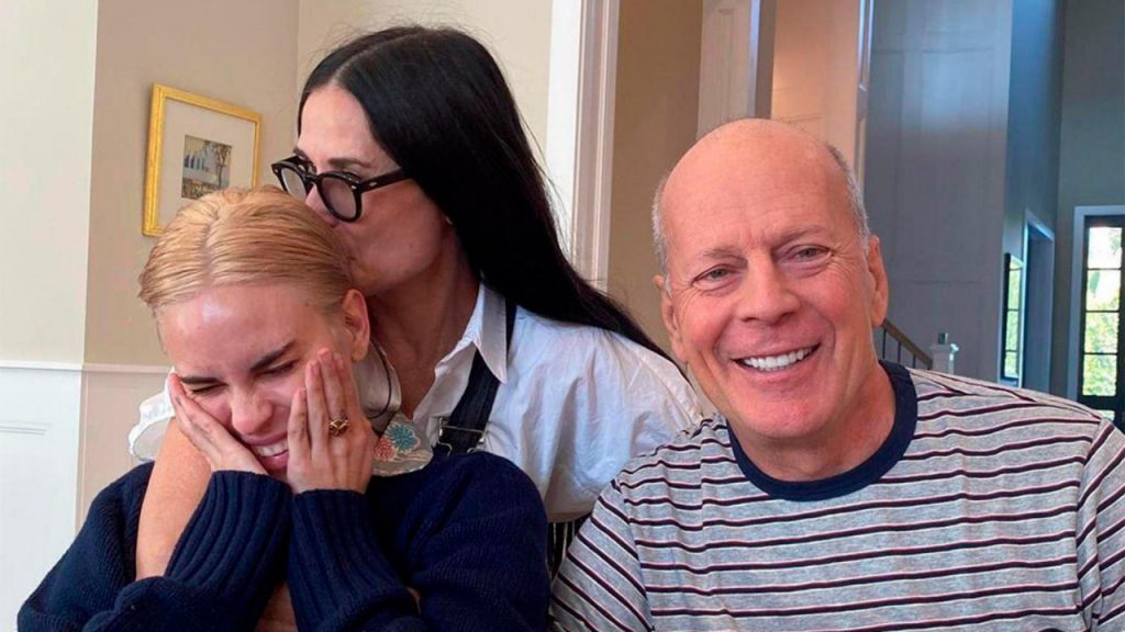 Wie sich die Krankheit entwickelt, die Bruce Willis betroffen hat Wie sich die Krankheit entwickelt, die Bruce Willis betroffen hat
